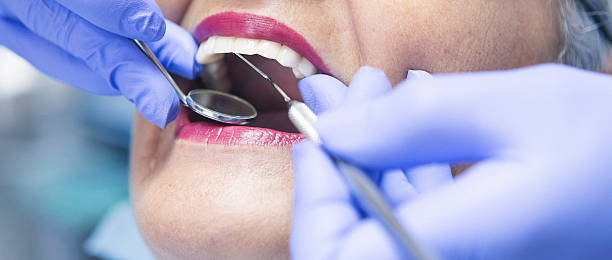 Best Chipped Tooth Repair Near Me  in Clewiston, FL